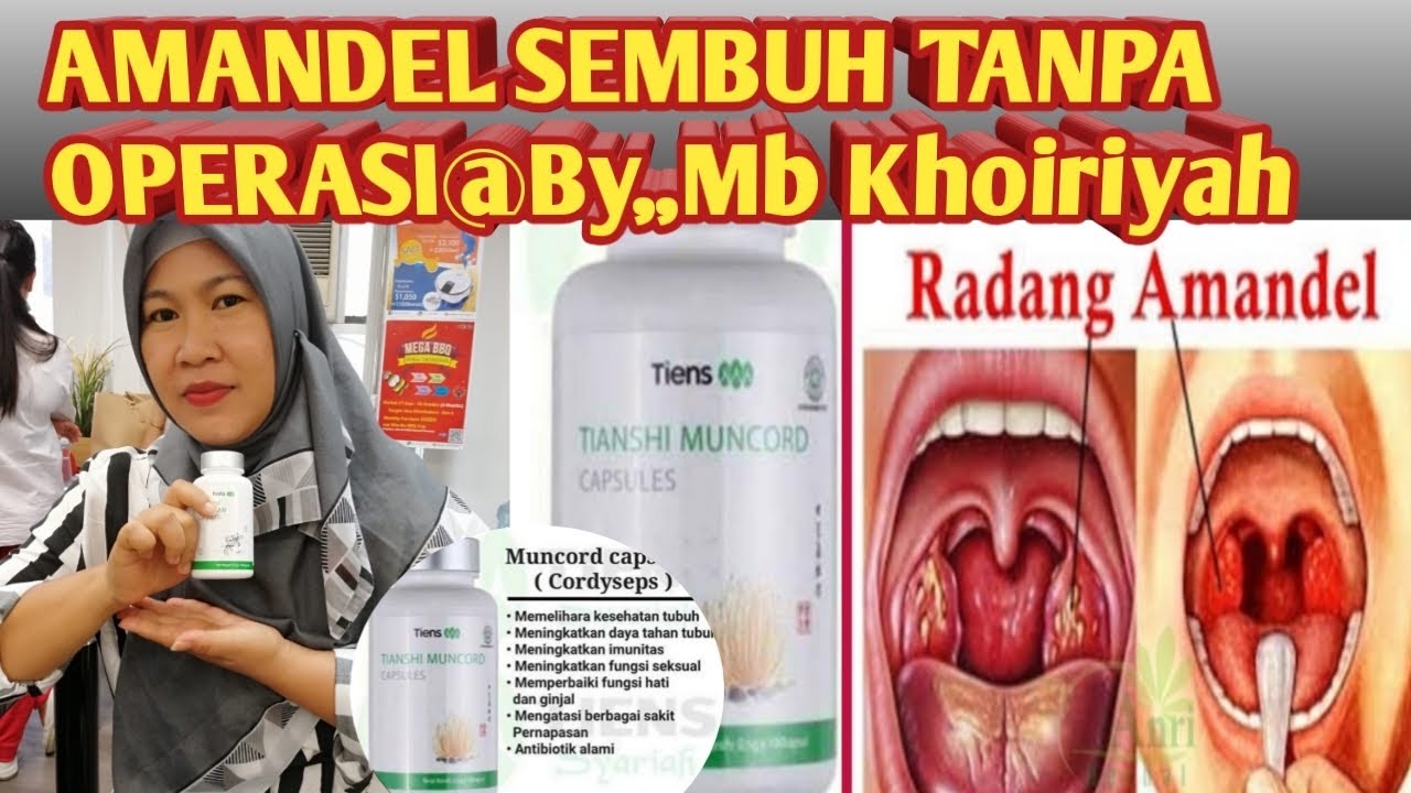 Kesaksian Sakit AMANDEL Sembuh Tanpa Operasi Minum Muncord Tiens