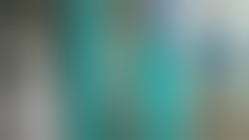 Learn Ilizarov web series - Video lecture 3 - Infected nonunion tibia with segmental bone loss