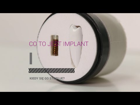 Wideo: Seksualne Więzi, Byty, Implanty - Alternatywny Widok
