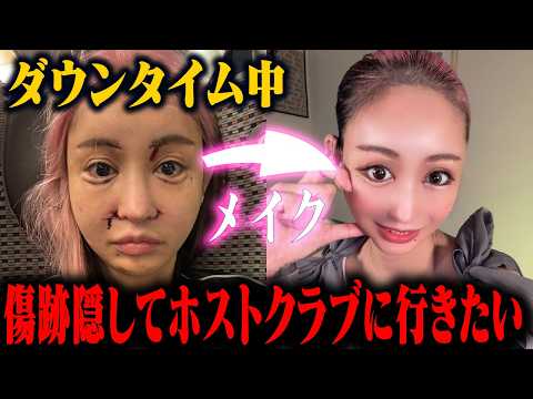 【神アイテム】整形をやり続ける私が必殺の小道具を特別に教えます！