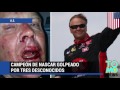 Campeón de NASCAR y su hija son atacados por tres hombres en un parqueadero