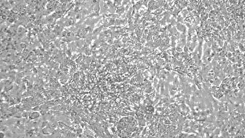 Cardiomyocytes Contracting After Developing from Embryonic Bodies