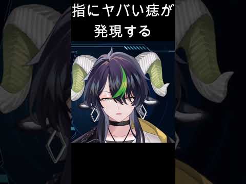 どう見ても「ち」の付くあれにしか見えない火傷 #vtuber #shorts #切り抜き