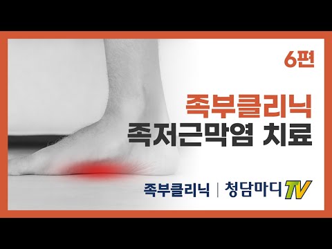[족부대표질환] 발바닥통증, 족저근막염 치료방법_청담마디신경외과 족부클리닉