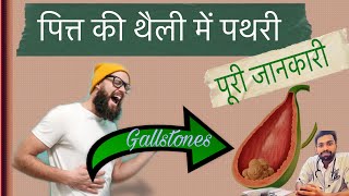 Gallbladder stones symptoms | Treatment | Gallbladder operation 3d animation | Dr.Tripathi Health ti