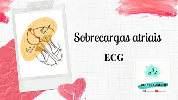 O que causa sobrecarga atrial?