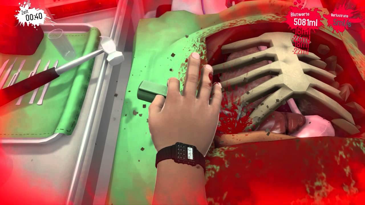 surgeon simulator ps4 walkthrough