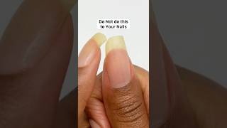 Don’t do This to Your Nails nails