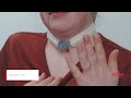 Atos Medical - How to change a tracheostomy dressing