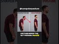 Stooped Posture: What it is and How to Fix it