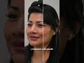 Diosa 1 mes después de su deep plane facelift con blefaroplastia y liplift #lifting #facelift