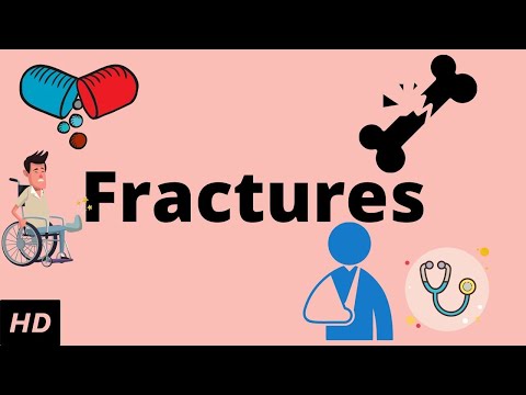 Fractures, Causes, Signs and Symptoms, Diagnosis and Treatment.