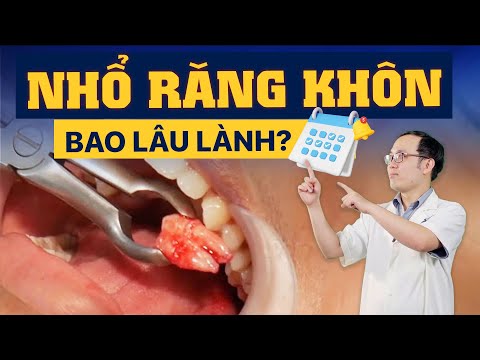 Nhổ Răng Khôn