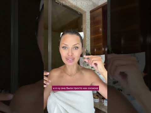 Виктория Боня рассказала что врач задел ей нерв и у нее упала губа стала как сосиска