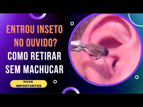 Vídeo: 3 maneiras de tratar a foliculite