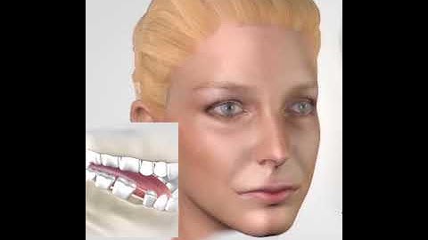 Mất răng là lý do làm bạn già đi #shorts