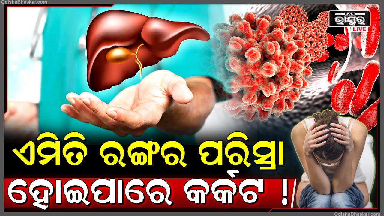 ଏମିତି ରଙ୍ଗର ପରିସ୍ରା ହେଉଛି କି ? ଆଗୁଆ ଜାଣିରଖନ୍ତୁ କ୍ୟାନ୍ସର ହୋଇଛି କି ନାହିଁ ?
