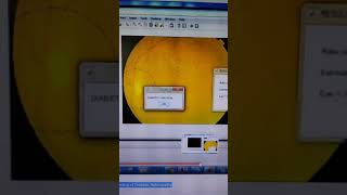 Automatic Detection of Retinal Lesions for Screening of Diabetic Retinopathy screenshot 5