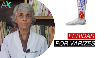 Como fazer curativo em feridas de varizes?
