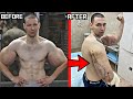 Russian Synthol Kid Has Oil Removal Surgery