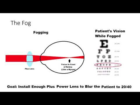 The Fog or how accommodation is controlled Source