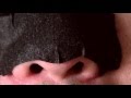 Nose Full Of Blackheads. Blackheads Removal With Pore Strips.