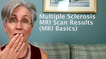 My Multiple Sclerosis MRI Scan Results (MRI Basics)