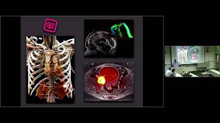 Basics of Radiology Modalities