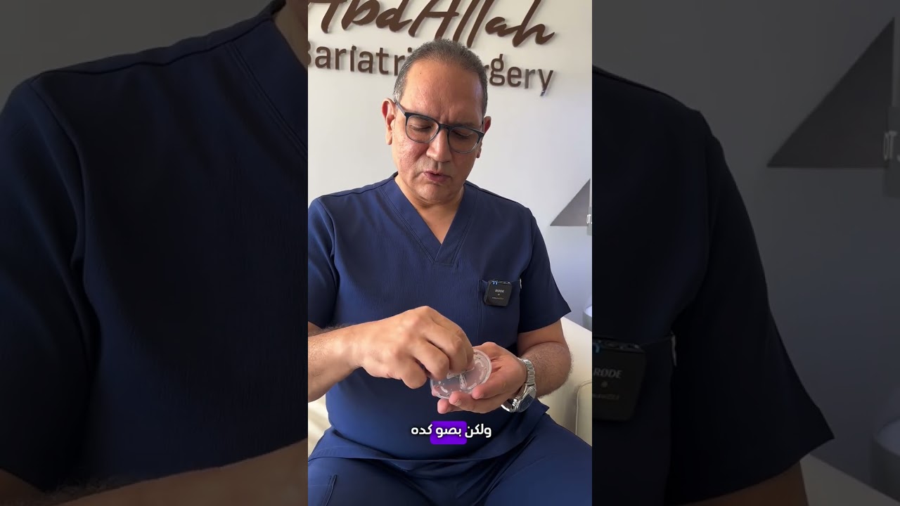 اعرف تفاصيل اكتر عن طي المعده الحديث#طي_المعدة #تحويل_المسار #تكميم_المعدة #فقدان_الوزن