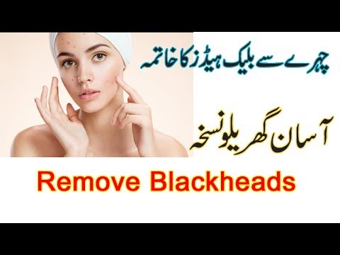 How to remove blackheads from  nose & face - Home remedy - natural way at home