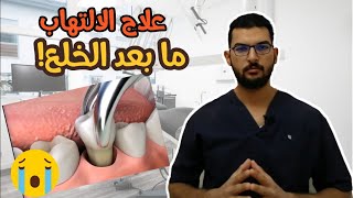 د.محمود مبارك | حصلك وجع بعد الخلع؟ الاحتياطات بعد خلع الاسنان  - مع علاج التهاب ما بعد خلع الاسنان