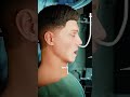 Tonsillectomy Procedure (3D animation) #music #motivation #epic #like