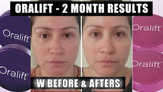 ORALIFT | 2 MONTHS RESULTS W BEFORE & AFTERS