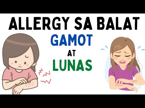 Video: Paano Kilalanin ang Mga Allergies ng Peanut: 15 Hakbang (na may Mga Larawan)