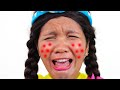 Im so itchy song  nursery rhymes  childrens song