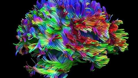 Whole brain fiber tractography