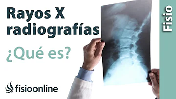 ¿A través de qué material se puede ver una radiografía?