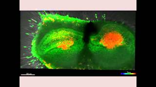 分割した歯胚のそれぞれにエナメルノットが形成される様子