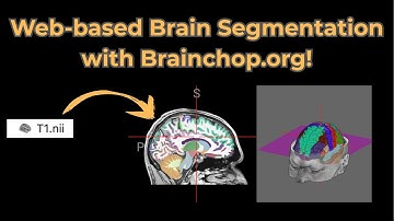 Web-Based Brain Segmentation with Brainchop.org!