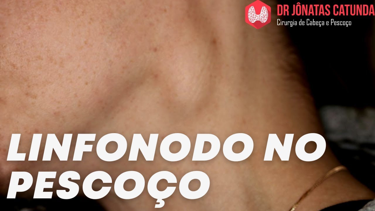 Linfonodo no pescoço  que surgiu do nada