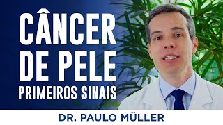 Câncer De Pele, Primeiros Sinais Dr. Paulo Müller Dermatologista.