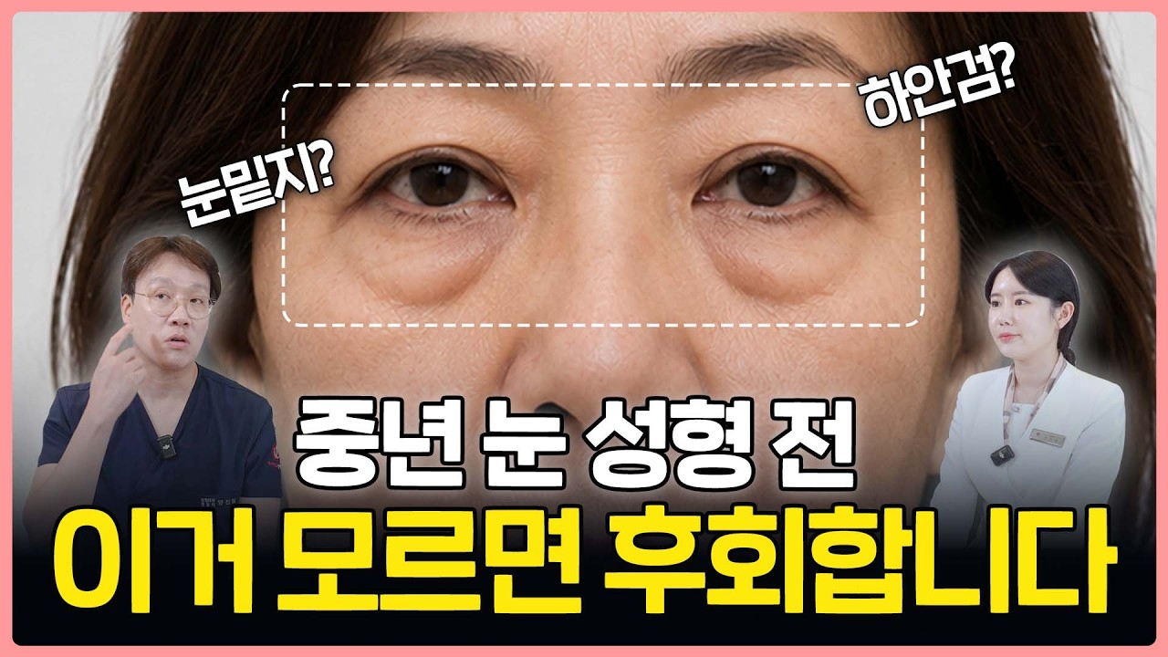 🚨 Lower Blepharoplasty: What Makes Those Who Get Amazing Results