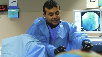 PAINCAST PREVIEW: Dr. Baher Yanni: Endoscopic Discectomy Procedure