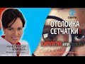 🔴 Отслойка сетчатки! Лечение - хирургия или капли? Как лечить?