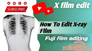 How to edit X ray film || x ray फिल्म कैसे बनाएं screenshot 5