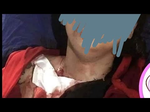 فيديو لغرفة زوجة المطرب جلال الزين التي وجدت مقتوله صباح اليوم