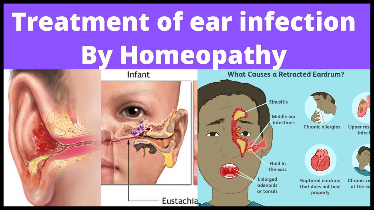 Treatment of ear infection by homeopathy, Asom Csom, the root cause of