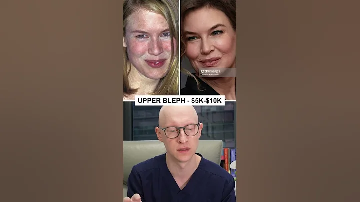 Renee Zellweger's Plastic Surgery Costs This Much! - DayDayNews