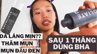 REVIEW BHA PAULA'S CHOICE | CÓ THẬT SỰ HOT VÀ TỐT??????