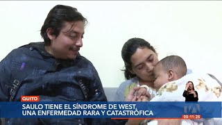 #ManosSolidarias: Padres de un bebé de 9 meses con síndrome de West buscan ayuda